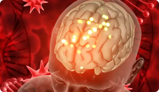 brain nerve inflammation